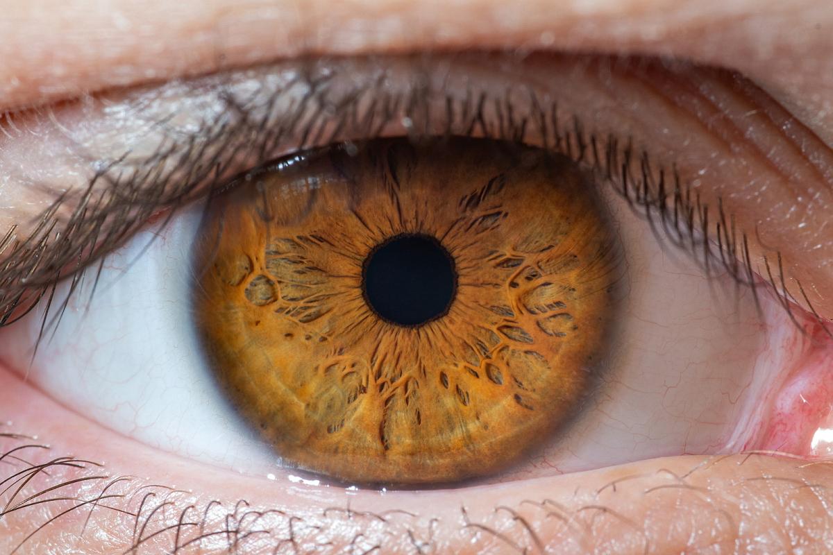 Iris & Aesthetic Contact Lens Studio